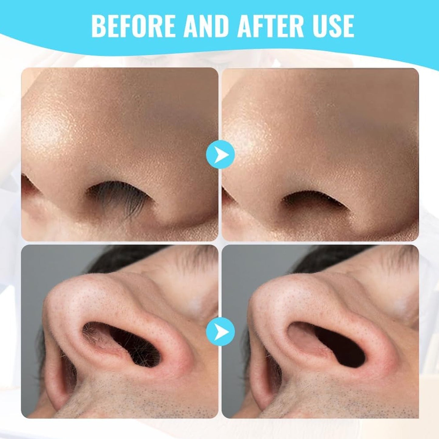 All accessories included in the PureBeard nose hair grooming kit.