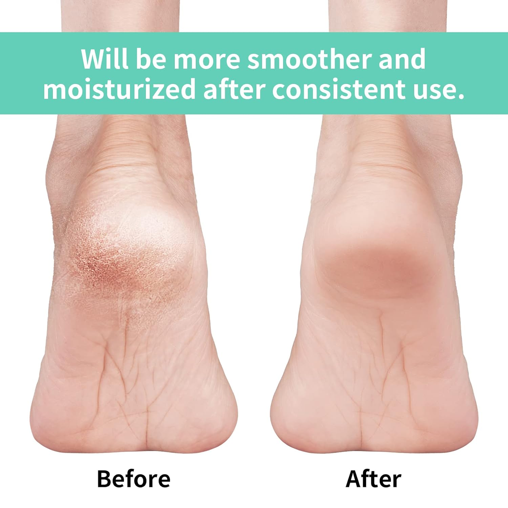 Infographic illustrating key features of the anti-crack silicone heel socks.